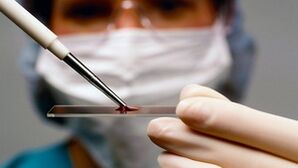 Diagnostic d'arthrottes et d'arthrose