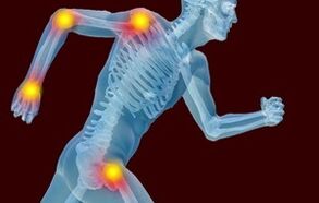 Les raisons du développement des arthrottes et de l'arthrose