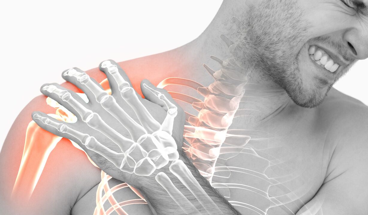 Douleur à l'épaule due à l'arthrose